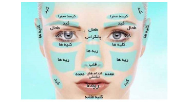 تشخیص 10 بیماری از روی چهره انسان (+عکس) 