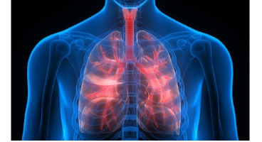 مهمترین نشانه‌های سرطان ریه 