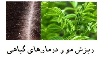 درمان ریزش مو با یک گیاه دارویی 