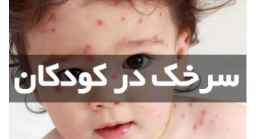 شیوع بیماری سرخک در کشور / واکسیناسیون کودکان را جدی بگیرید