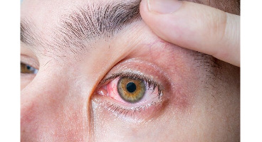  تشخیص هفت بیماری خطرناک از روی چشم
