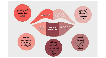 تغییر رنگ لب‌ نشانه کدام بیماری است؟